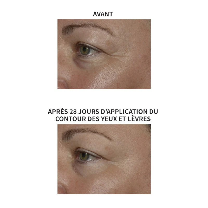 Lys Active Contour des yeux & lèvres - avant et après